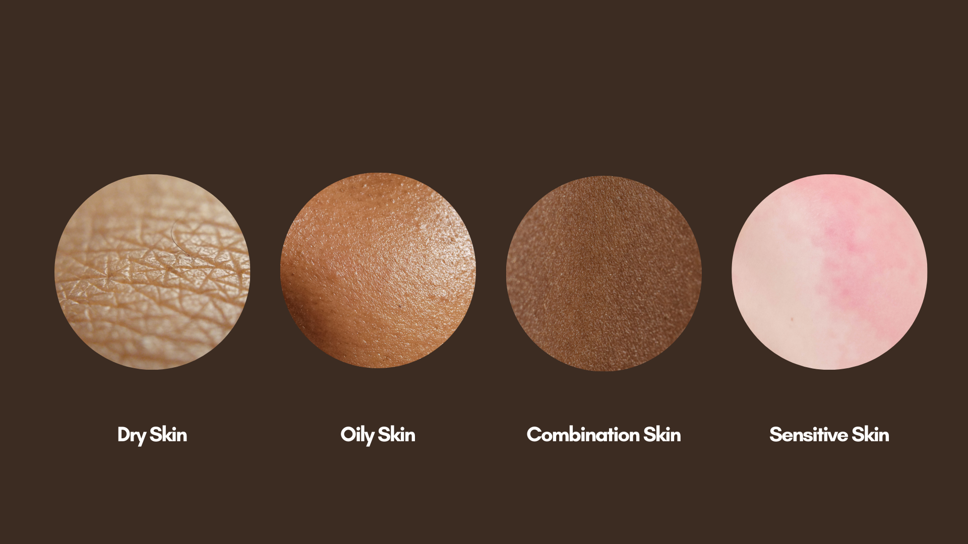 Understanding Skin Types